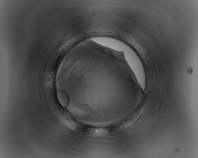 X0000099950165200806201322