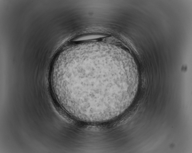 X0000099950538200806201315
