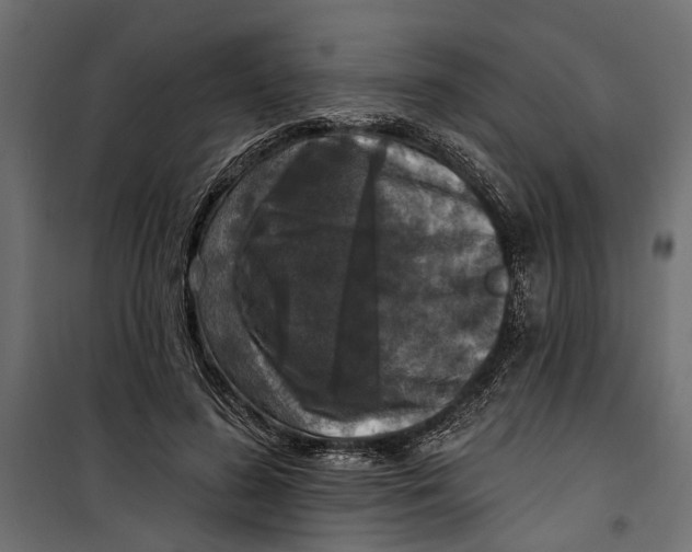 X0000099950596200806201315