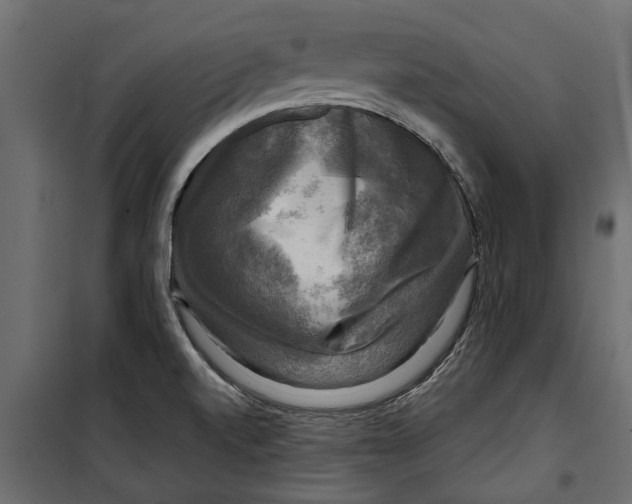 X0000099951520200806201301