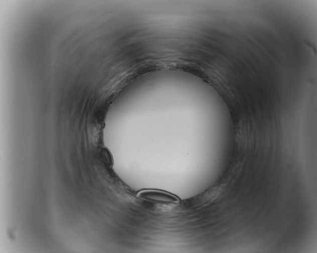 X0000099960139200805231036