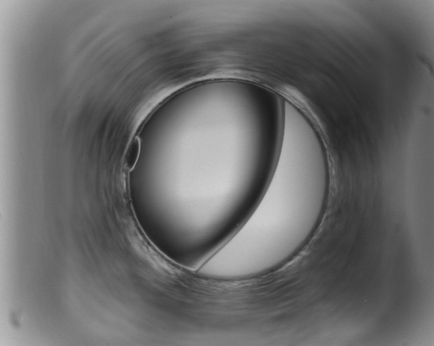 X0000099961292200805231017