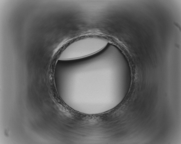 X0000099961400200805231015