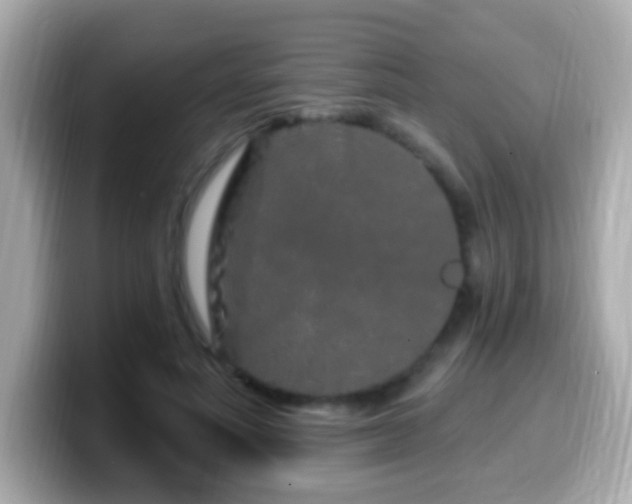 X0000099960691200805231341