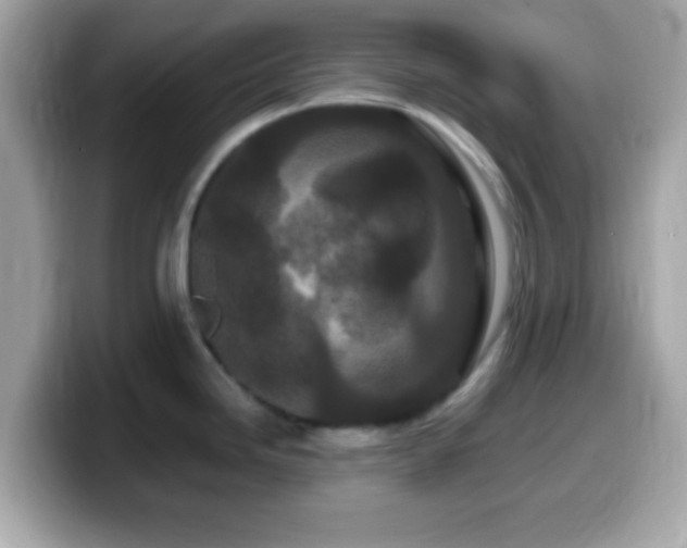 X0000099961246200805231335