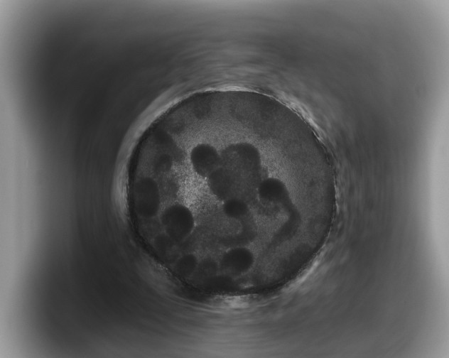 X0000099960295200805301319