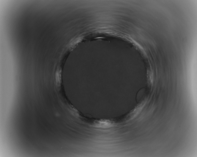 X0000099960475200805301317