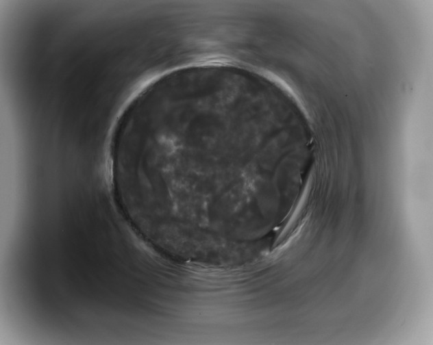 X0000099961414200805301305
