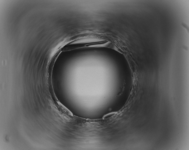 X0000099960150200806061614