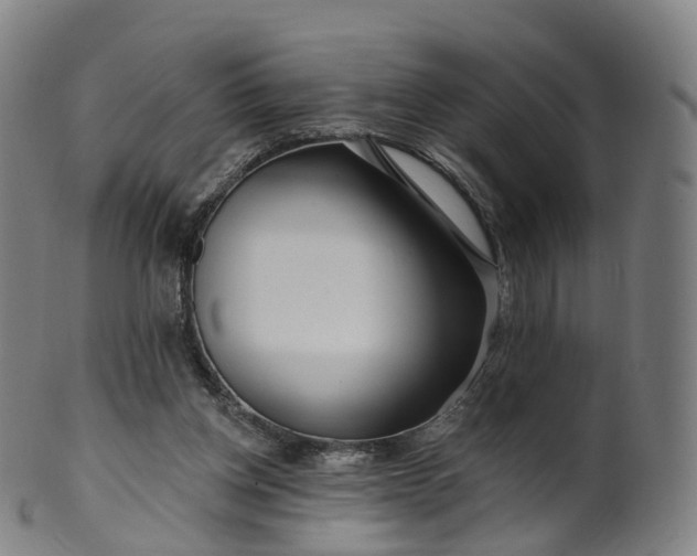 X0000099960158200806061614