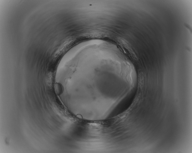 X0000099960167200806061614