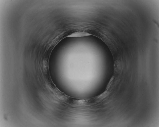 X0000099960184200806061614