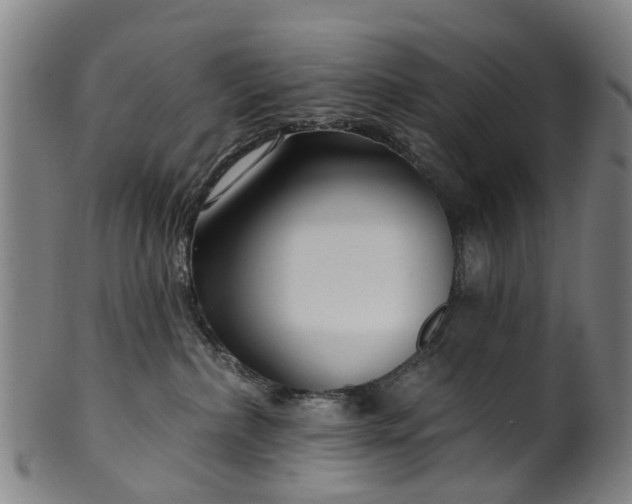 X0000099960236200806061613
