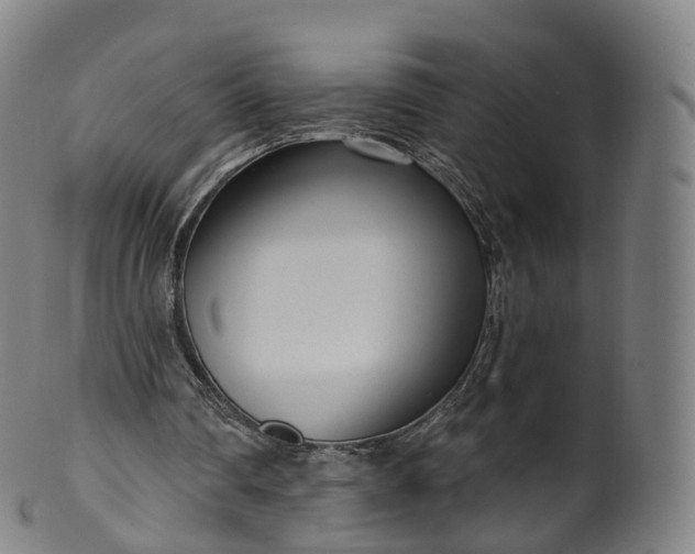 X0000099960290200806061612