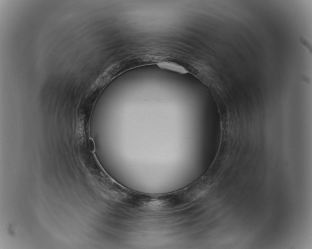 X0000099960312200806061612