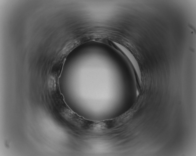 X0000099960333200806061611