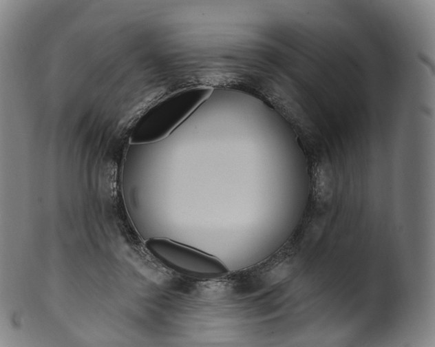 X0000099960356200806061611