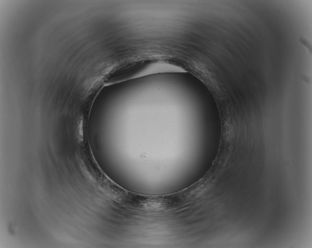 X0000099960358200806061611