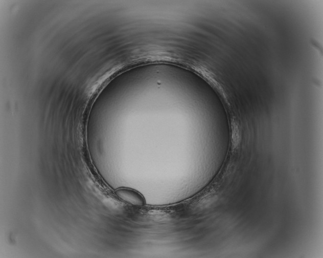 X0000099960390200806061611