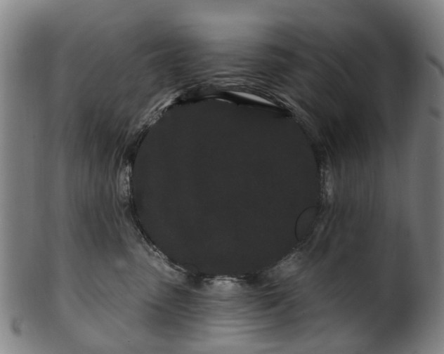 X0000099960475200806061610