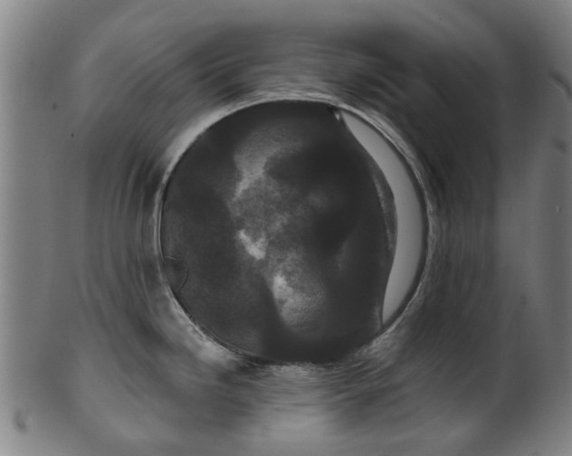 X0000099961246200806061558