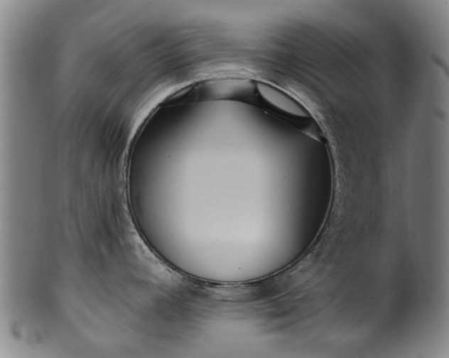 X0000099961392200806061556