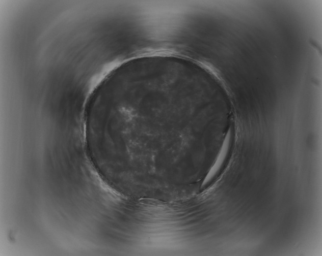 X0000099961414200806061555