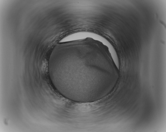 X0000099960029200806131520