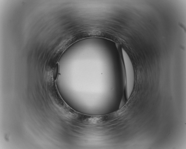 X0000099960172200806131518