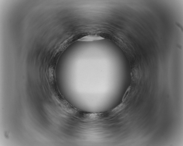 X0000099960184200806131518