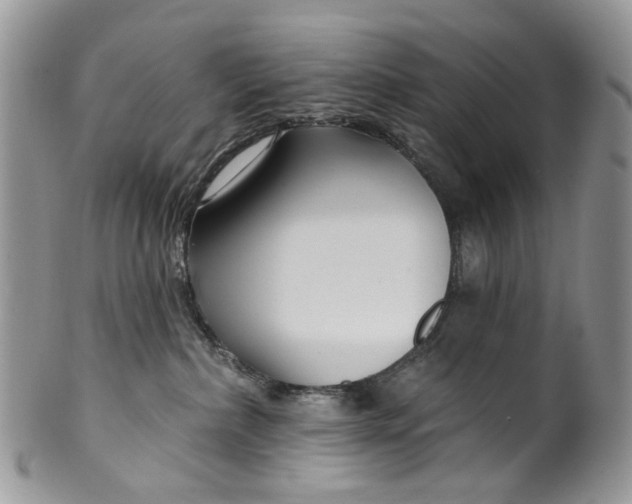 X0000099960236200806131517