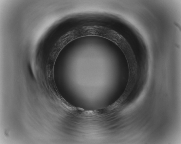 X0000099960239200806131517