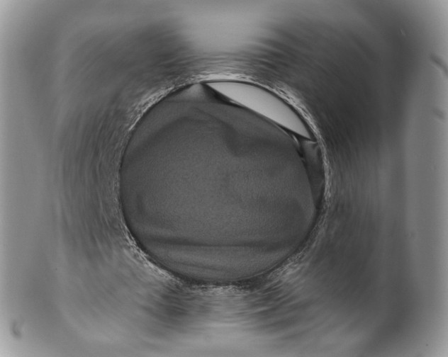 X0000099960385200806131515