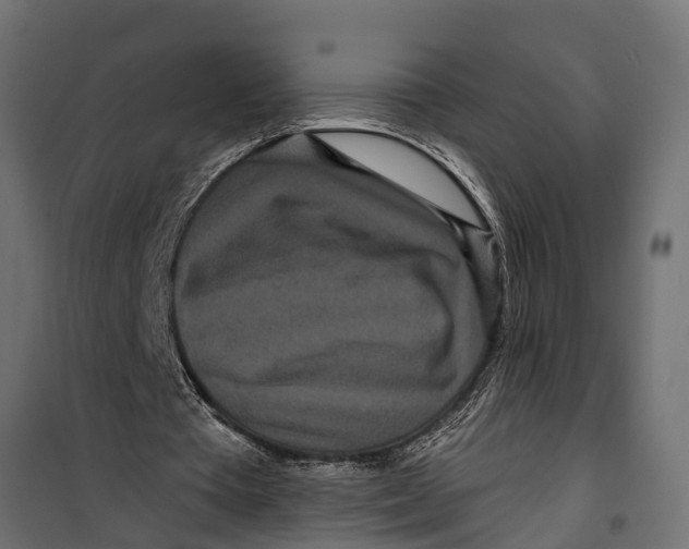 X0000099960385200806201342