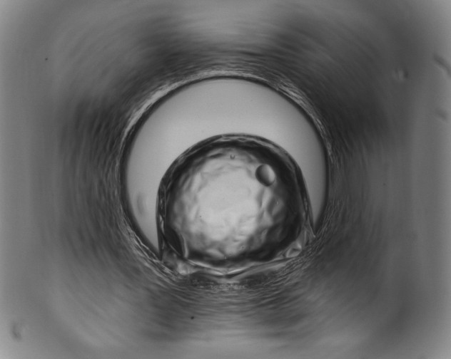 X0000099970387200806061635