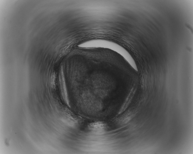 X0000099970219200806131539