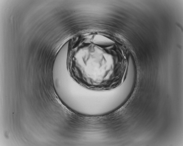 X0000099971185200806131525