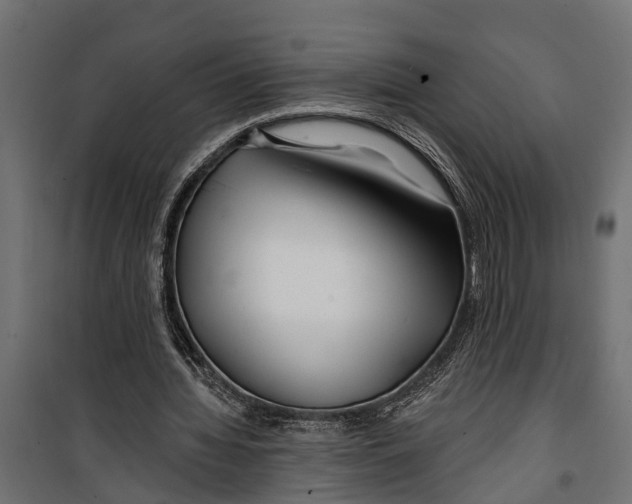 X0000099970436200806201405