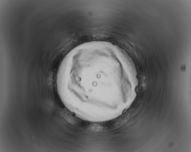 X0000099970519200806201405