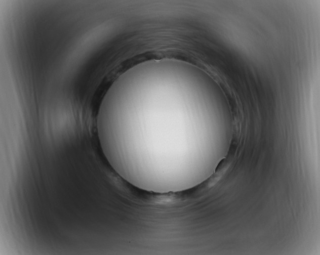 X0000099980574200805231026