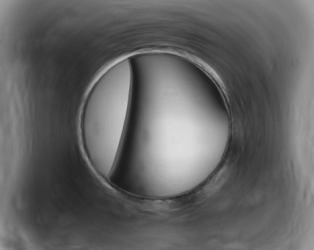 X0000099981533200805231012