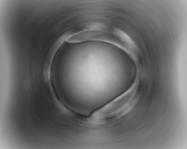X0000099980946200805231422