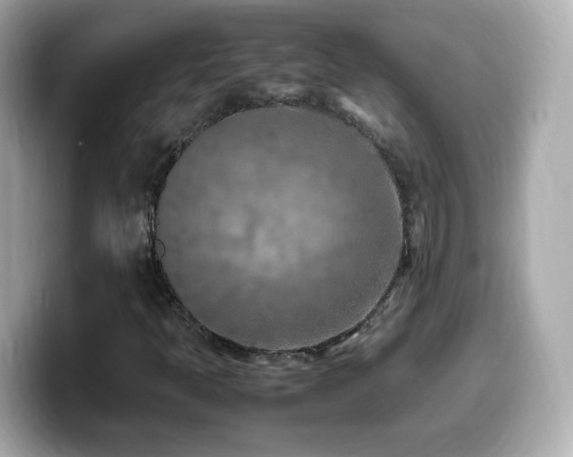 X0000099981397200805231415