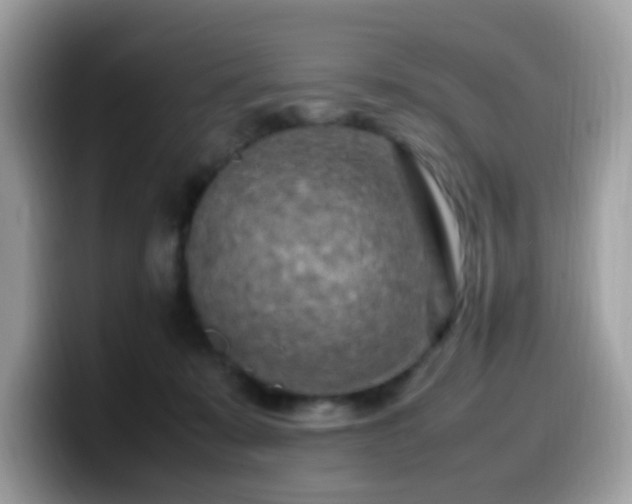 X0000099980319200805301358