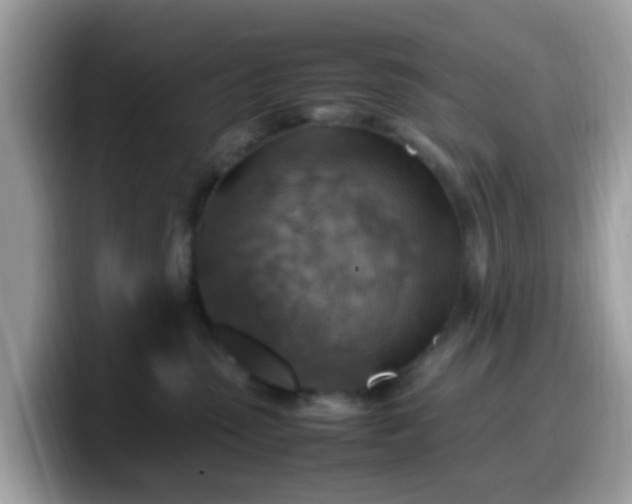 X0000099980475200805301357