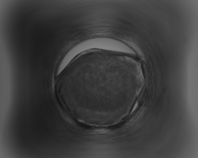 X0000099980397200806061528