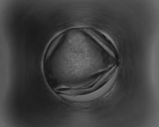 X0000099981197200806061516