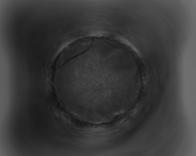 X0000099981256200806061516