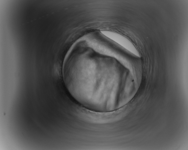 X0000099980035200806131408