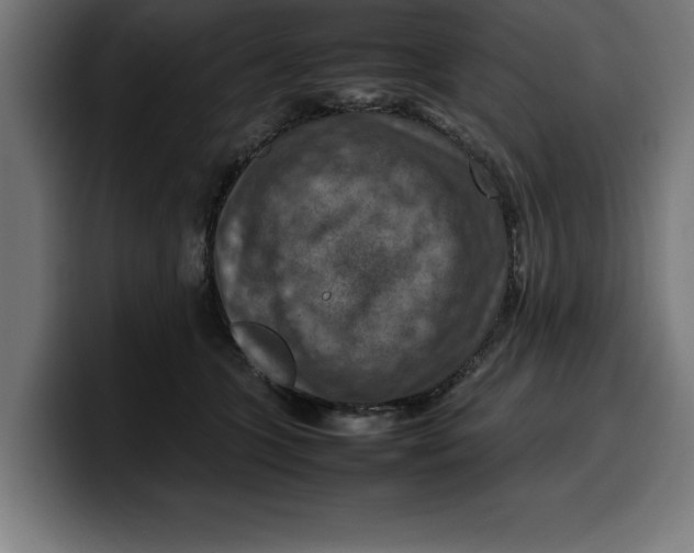 X0000099980563200806131401